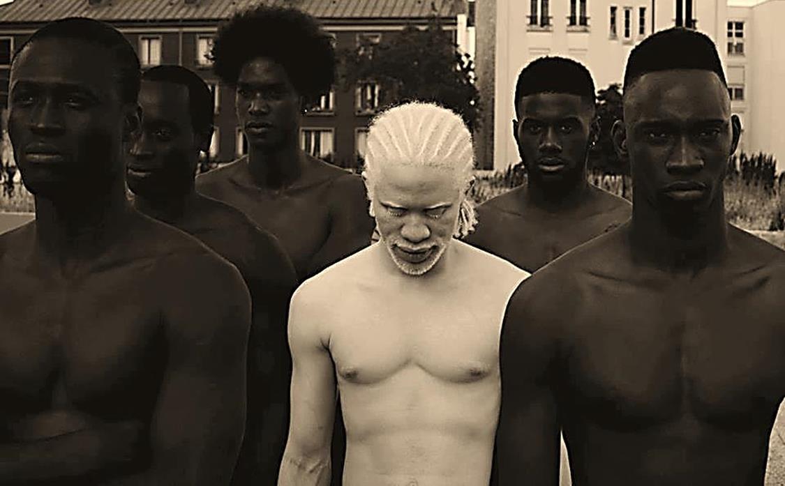 Black Men with Albino boy
