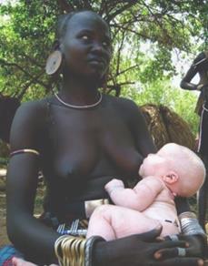 White child from Black parents