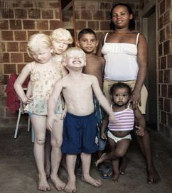 White child from Black parents